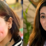 Hania Aamir, dimpleplasty, cosmetic procedures, dermatologist, Pakistani actress